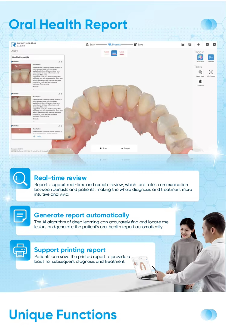 YP-11 Dental 3D Intraoral Scanner with Color Scanning for Restorative, Implant and Orthodontic